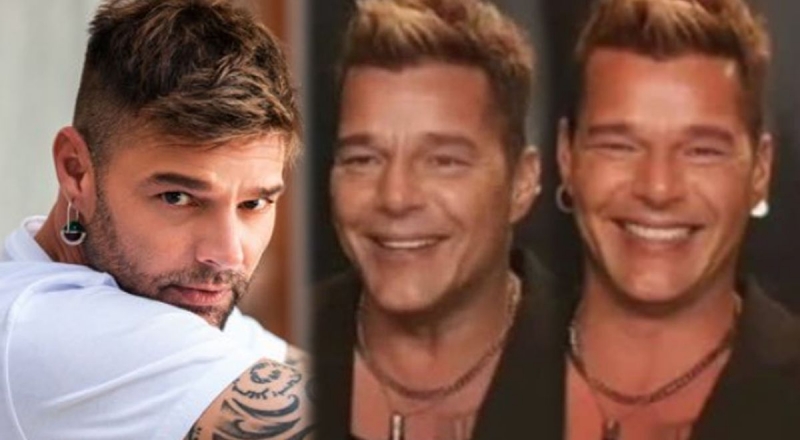 Ricky Martin is shown in networks with a renewed face and quickly goes viral